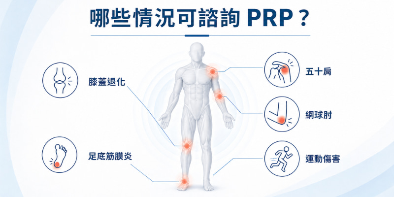 5大症狀可諮詢PRP