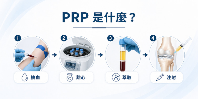 PRP